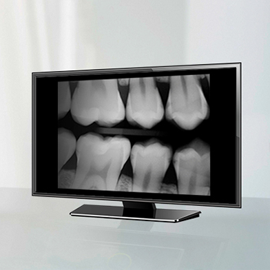 Monitor with teeth X-ray