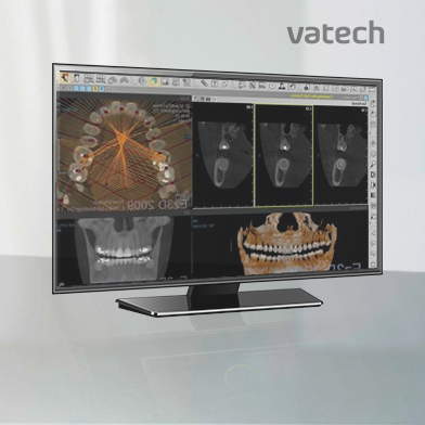 Vatech X-ray on monitor image